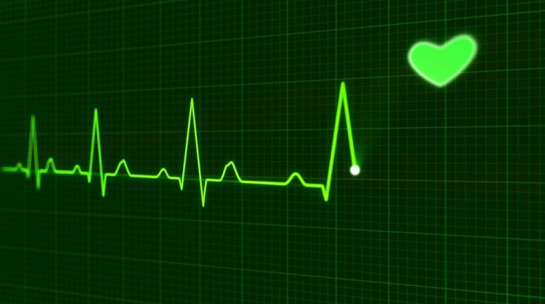 医疗器械进销存系统分类有哪些 医疗器械进销存系统的实施流程及关键步骤